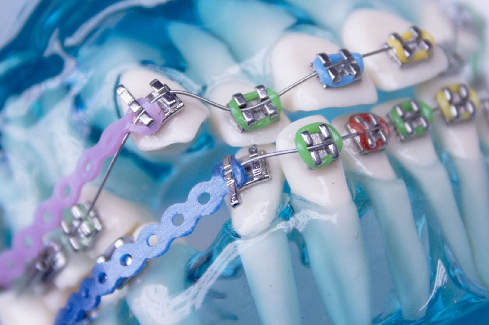 Ortodonti ve Çocuk Dişleri ile ilgili Sorular